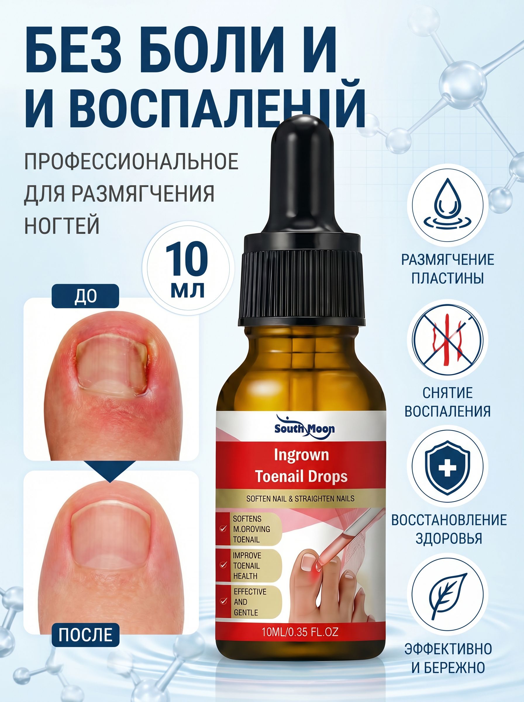 Профессиональныекаплиотвросшегоногтя,размягчительногтевойпластины,уходзастопами,10мл
